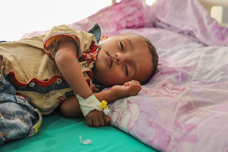 تقرير دولي يحذر من ارتفاع مقلق في حالات سوء التغذية والكوليرا بين أطفال اليمن