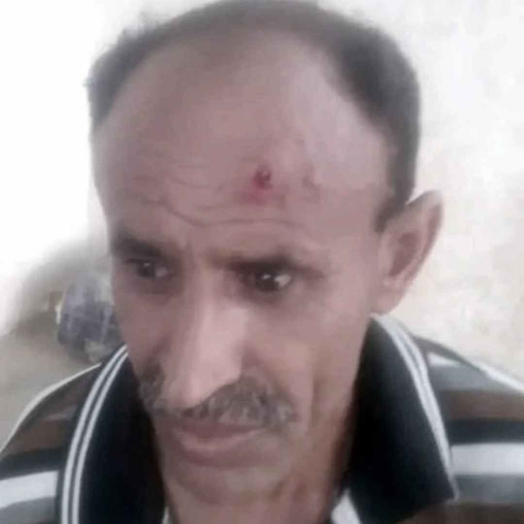 الحديدة: اعتداء قيادي حوثي على فرد أمن في مديرية الجراحي.. المليشيا تتجاوز الخطوط الحمراء